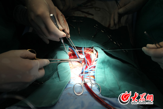 9:35���t�o�ˆT���ٵĴ�������������a��p��