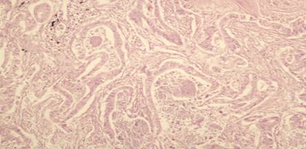 ����2+�зֻ��ٰ�