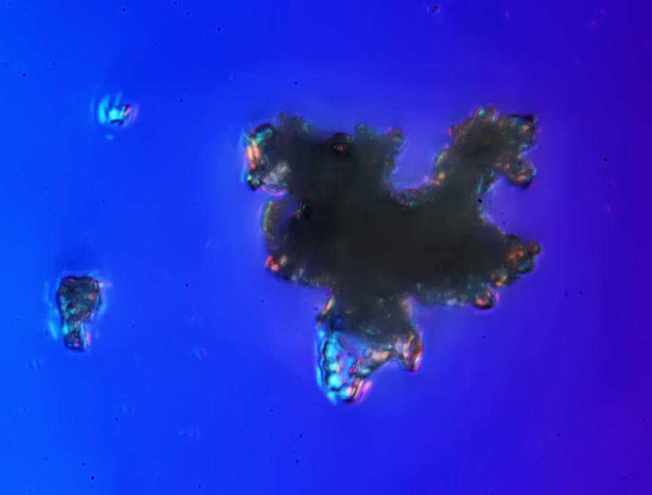 �@�M�DƬ��ͨ�^�@΢�R�������w���Ŵ�1000�������l�F�����Π�������Џͺ��w���������w�����еV���|�ģ�����ȥ�|Ŀ�@����